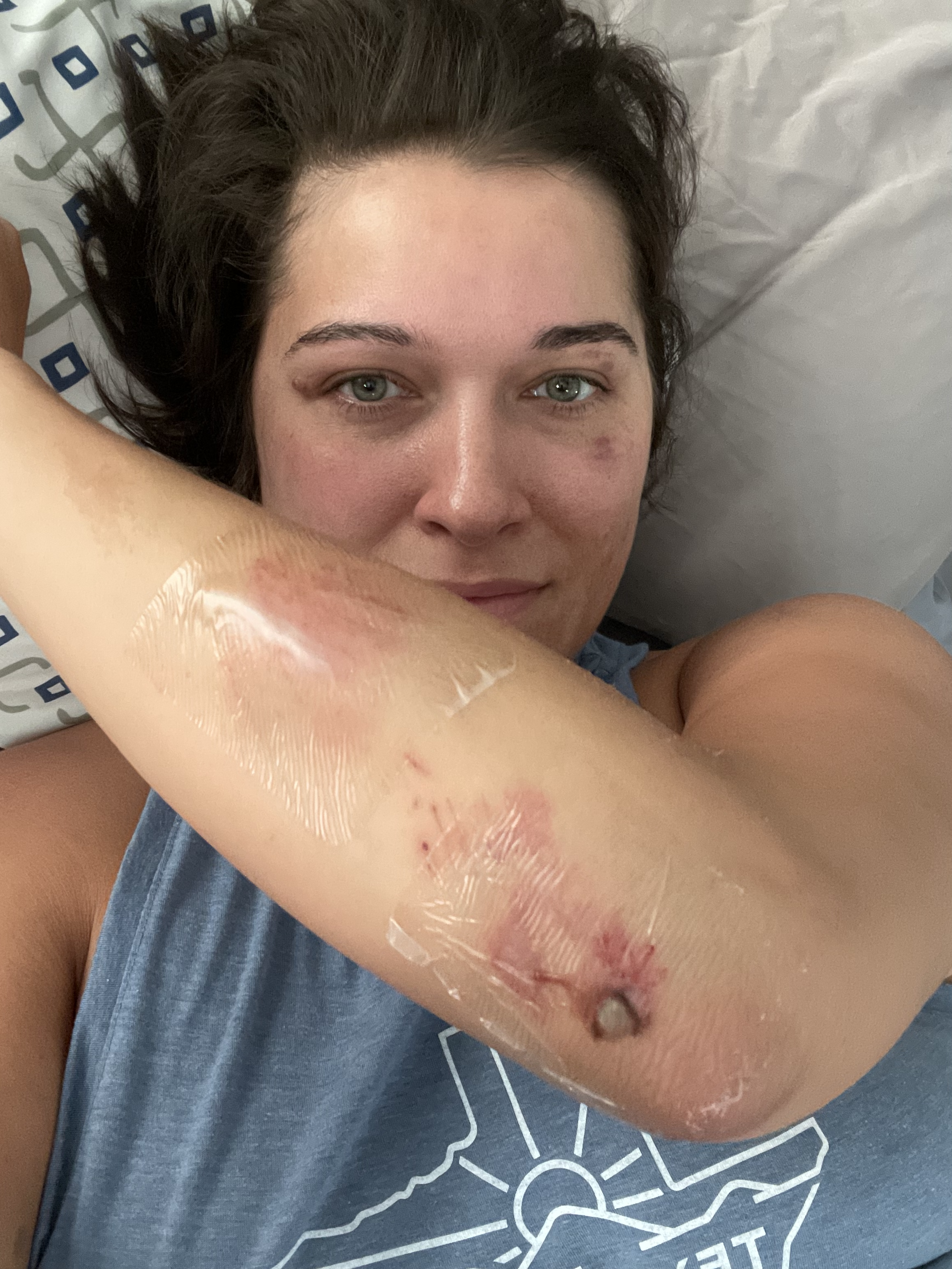 Image for story Getting back on the horse...or bike after a fall
