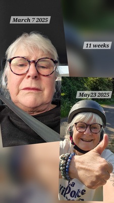 Image for story ITS POSSIBLE AFTER HIP SURGERY 